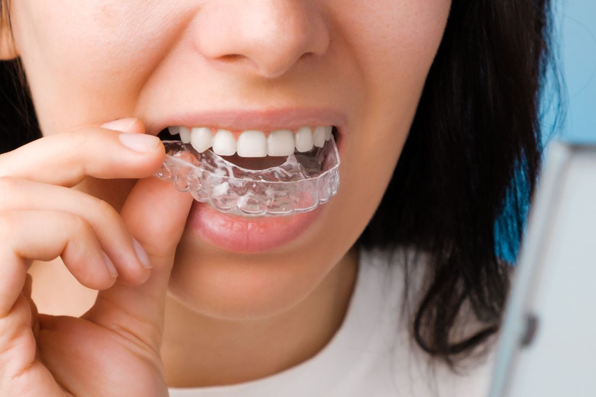 Patient removing clear aligners during daily dental care routine