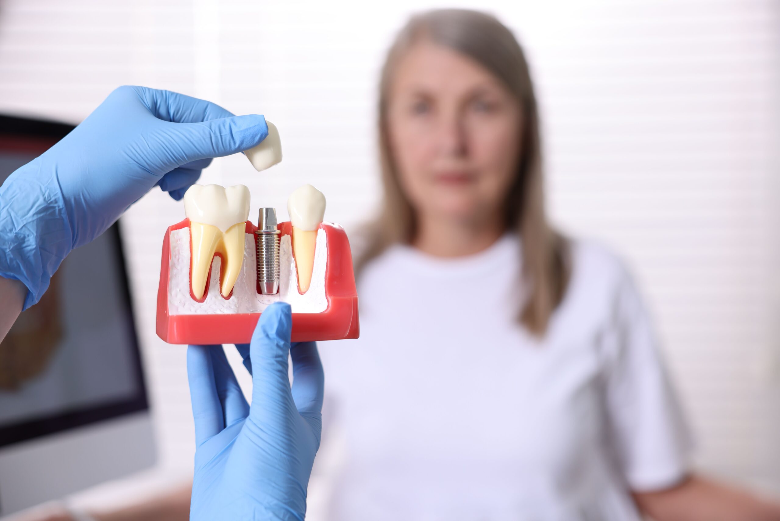Dental Implant Risks: 7 Things to Know